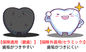 ホームホワイトニングについて