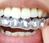 ホームホワイトニングについて